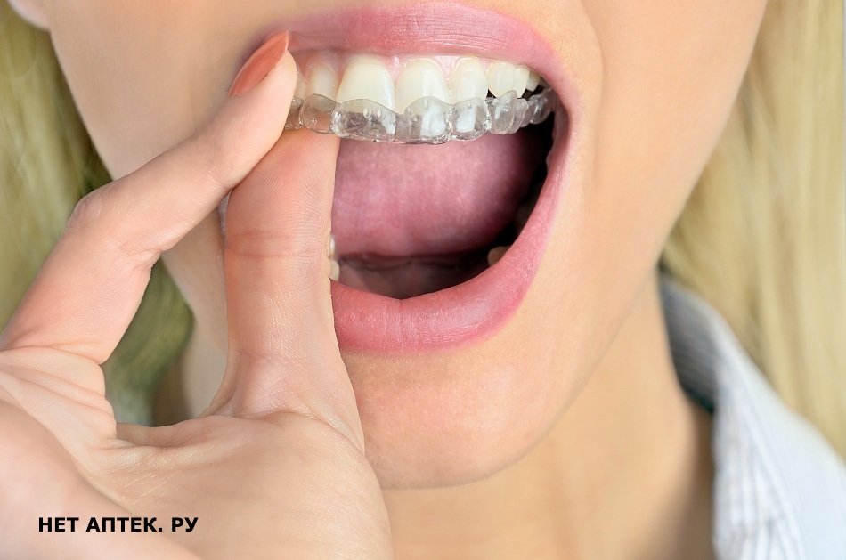 Отбеливаем зубки дома: 4 самых простых способа